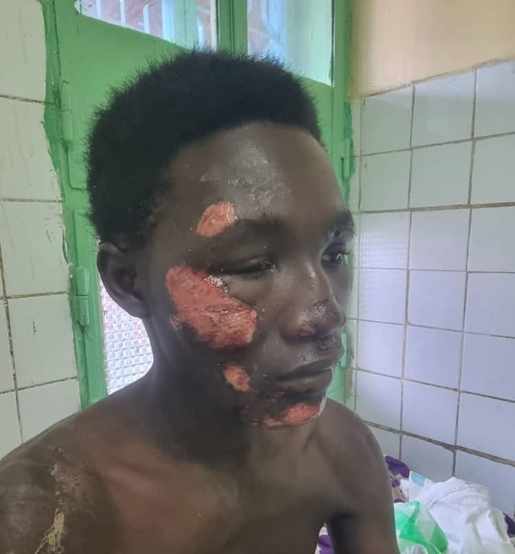Tchad : un père dénonce l'insécurité après une agression près du camp 27